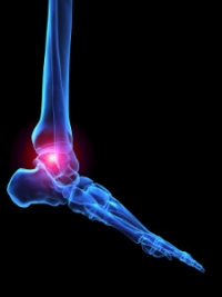 New Method in Treating Arthritic Foot Ailment