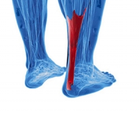 Sports and Achilles Tendon Injuries